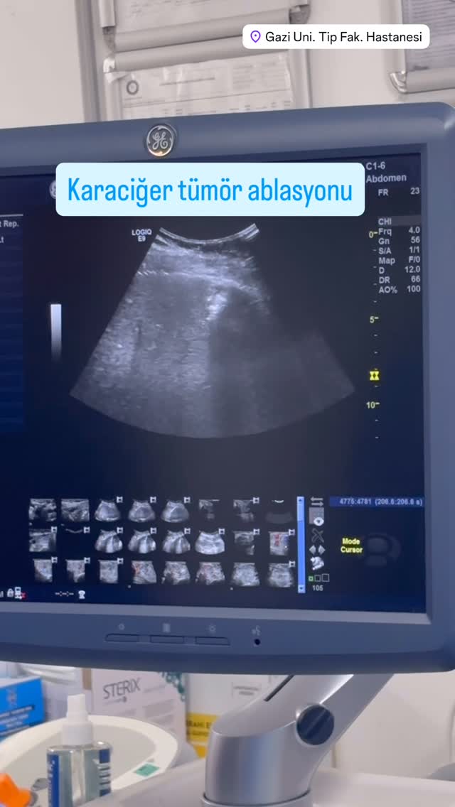 Tiroid Ablasyon Vakası