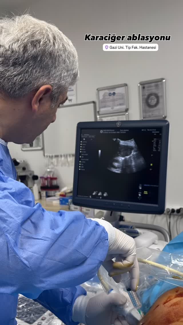 Interventional Procedure Case