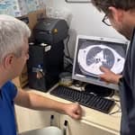 Lung Biopsy